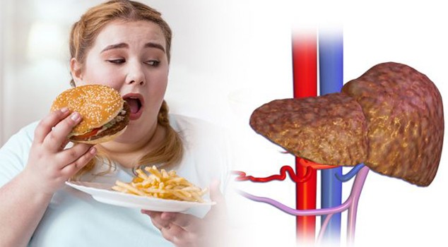 Así es como la comida rápida afecta la salud del hígado